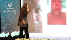 تیزر سومین سخنرانی نانویی 
از درد آمپول تا {نه به جراحی پلاستیک}