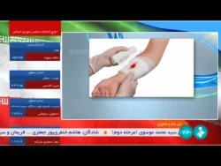 محققان برای جلوگیری از خون ریزی ، نانو محصولی از جنس صدف و پیله کرم ابریشم تولید کردند.