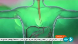 متخصصان یک شرکت دانش بنیان موفق شدند نوعی نانو دارو بسازند که علاوه بر کنترل درمان بیماران سرطانی موجب کاهش وابستگی کشور به دارو در خارج می شود