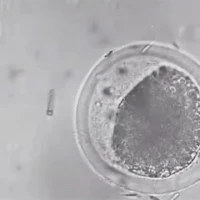 نانوبات موتوردار که به یک اسپرم دچار مشکل حرکت کمک می‌کند تا به سمت تخمک برود!